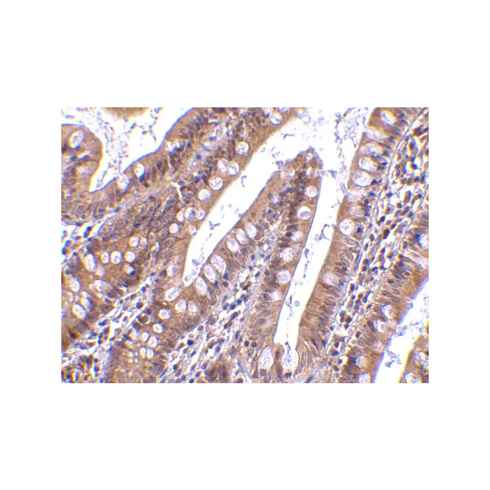 ProSci 2319_S CIDE-B Antibody, ProSci, 0.02 mg/Unit Secondary Image