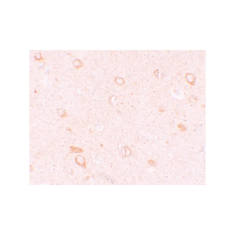 ProSci 5979 CIITA Antibody, ProSci, 0.1 mg/Unit Secondary Image