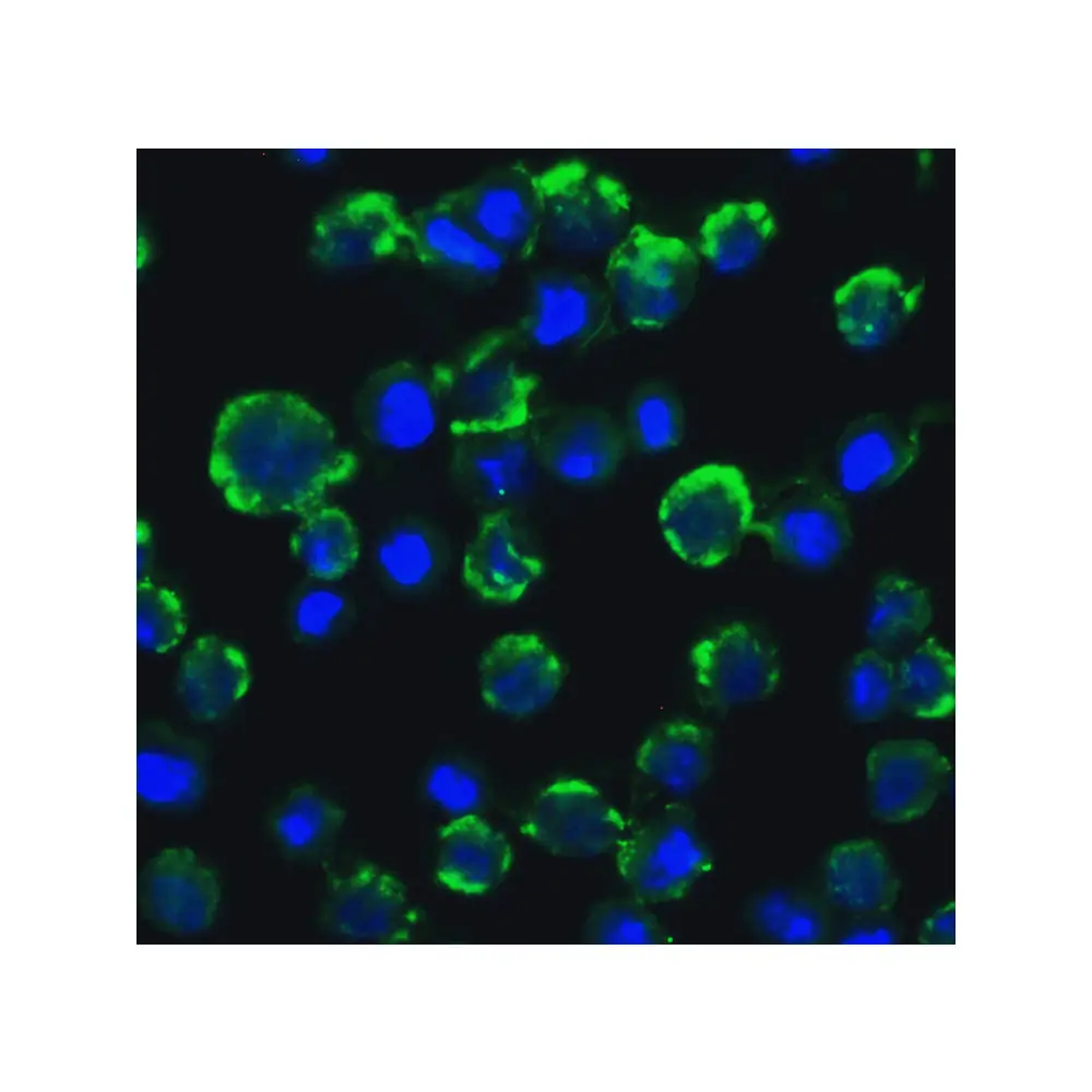 ProSci 2501_S CIKS Antibody, ProSci, 0.02 mg/Unit Quaternary Image