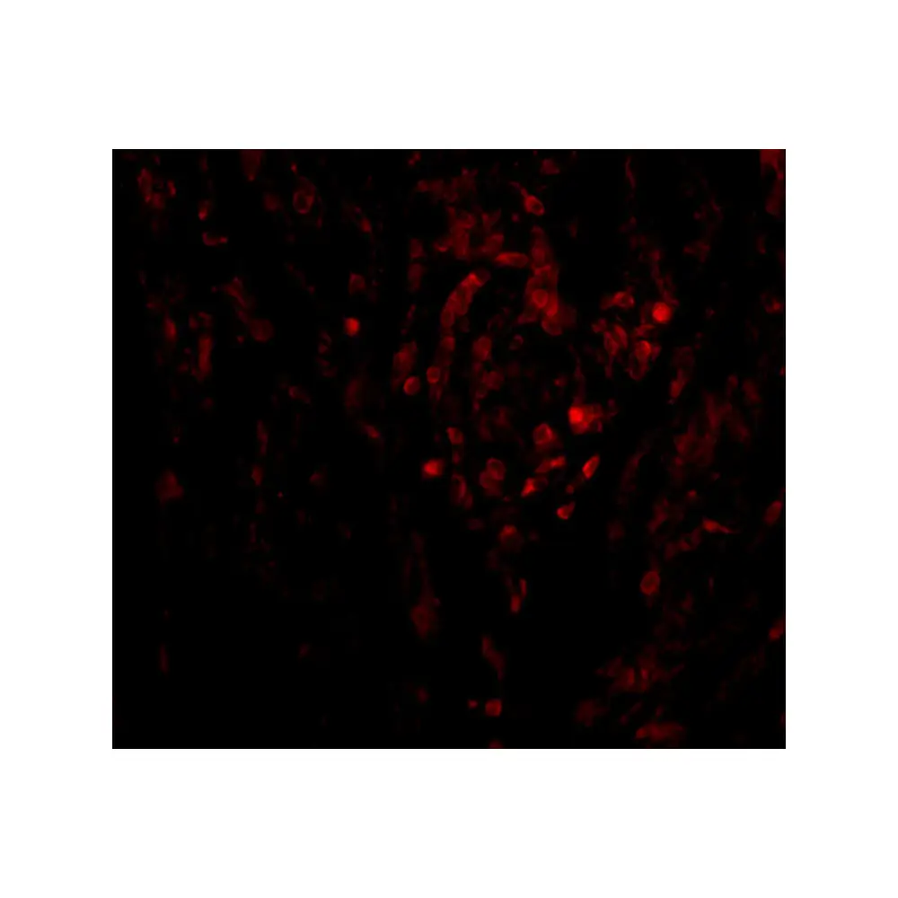 ProSci 2501_S CIKS Antibody, ProSci, 0.02 mg/Unit Tertiary Image