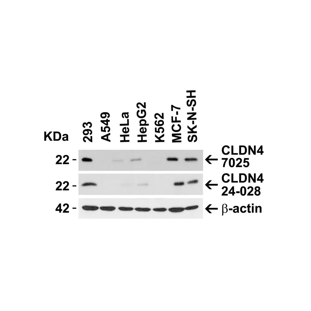 ProSci 7025 CLAUDIN4 Antibody, ProSci, 0.1 mg/Unit Primary Image