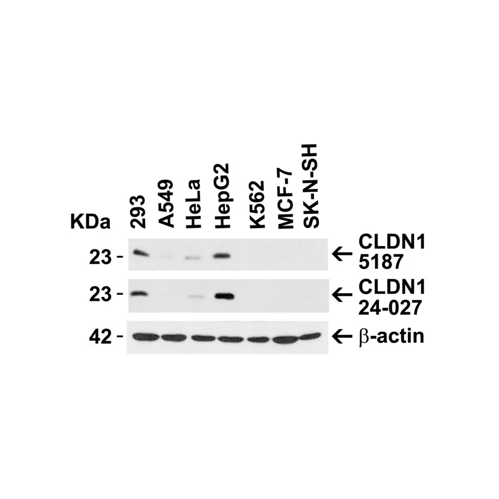 ProSci 5187 CLDN1 Antibody, ProSci, 0.1 mg/Unit Primary Image