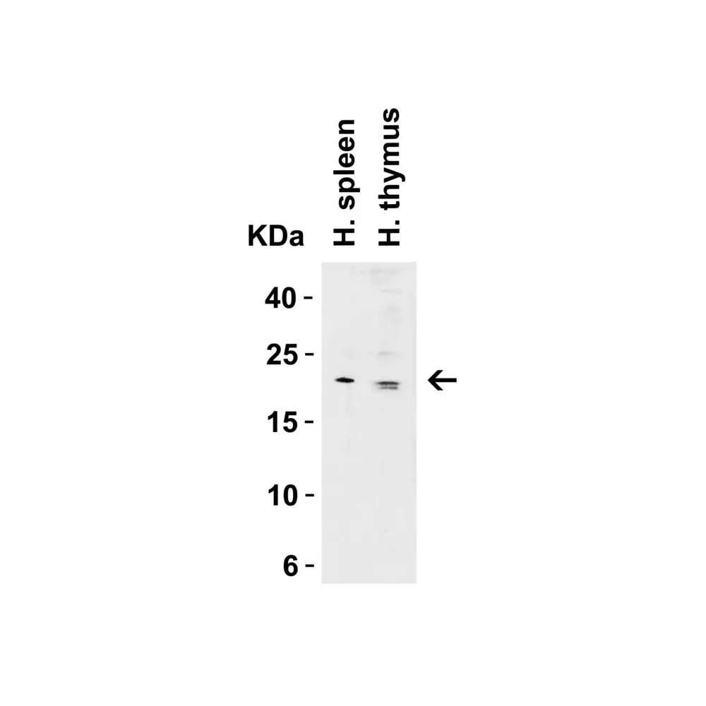 ProSci 5187 CLDN1 Antibody, ProSci, 0.1 mg/Unit Tertiary Image