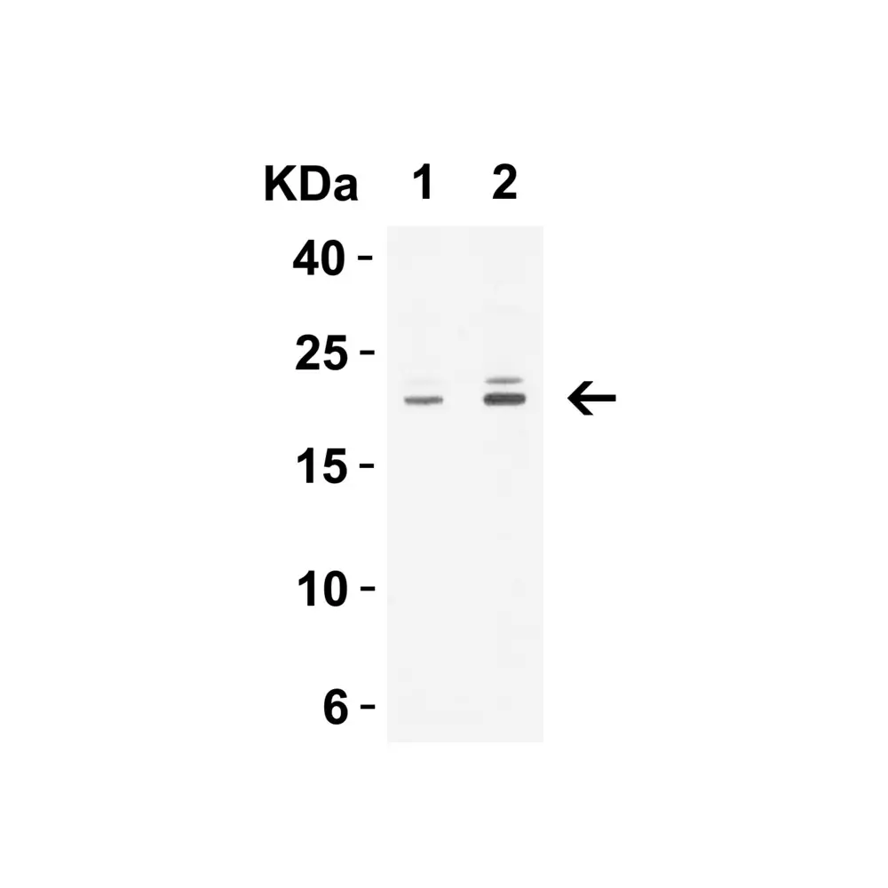 ProSci 5187_S CLDN1 Antibody, ProSci, 0.02 mg/Unit Quaternary Image