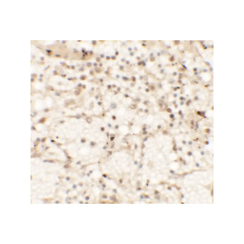 ProSci 6833 CLEC7A Antibody, ProSci, 0.1 mg/Unit Secondary Image