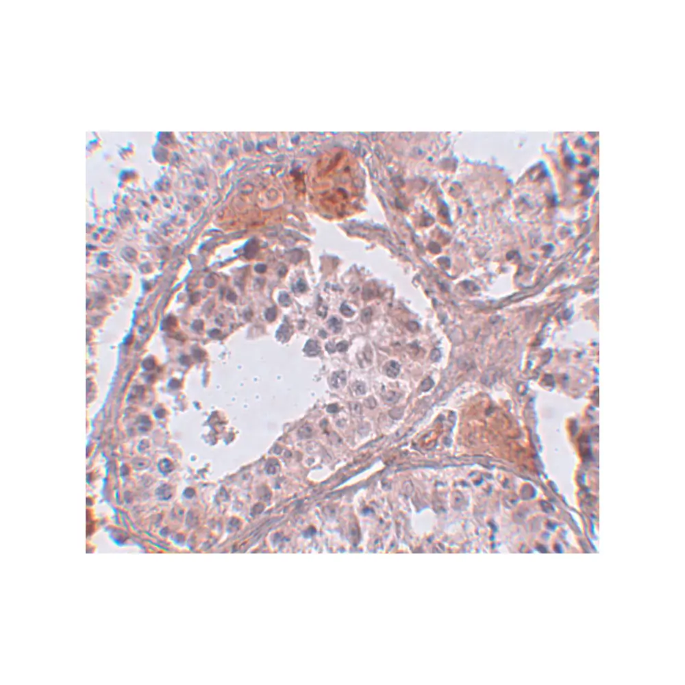 ProSci 5497_S CLPH Antibody, ProSci, 0.02 mg/Unit Secondary Image