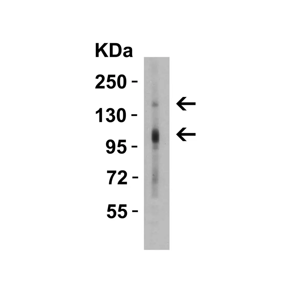 ProSci 7155 CRB2 Antibody, ProSci, 0.1 mg/Unit Primary Image