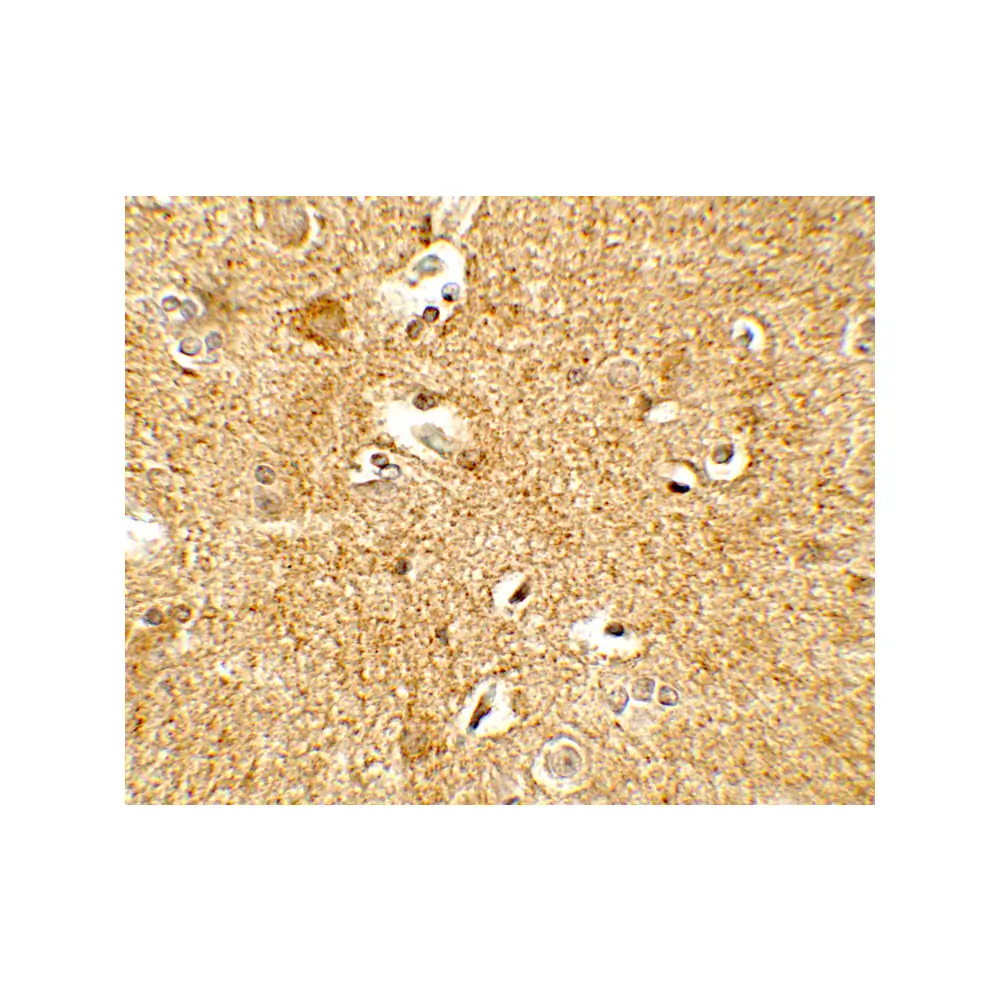 ProSci 7797_S CRH Antibody, ProSci, 0.02 mg/Unit Secondary Image