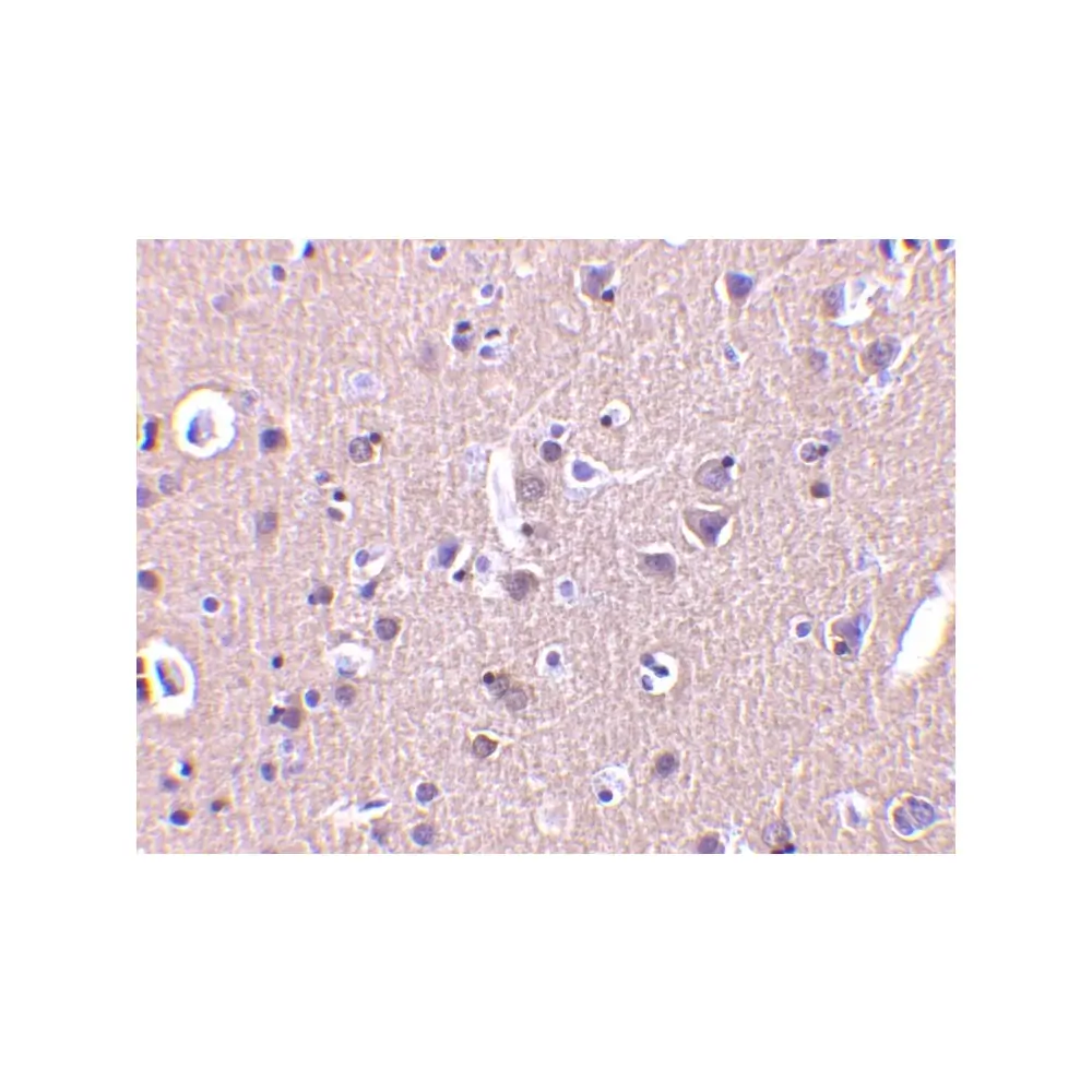 ProSci 3623_S CRMP1 Antibody, ProSci, 0.02 mg/Unit Secondary Image