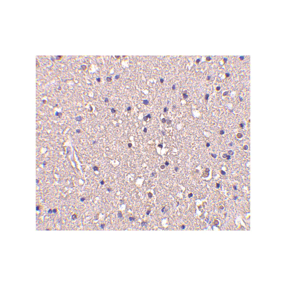 ProSci 3625_S CRMP1 Antibody, ProSci, 0.02 mg/Unit Secondary Image