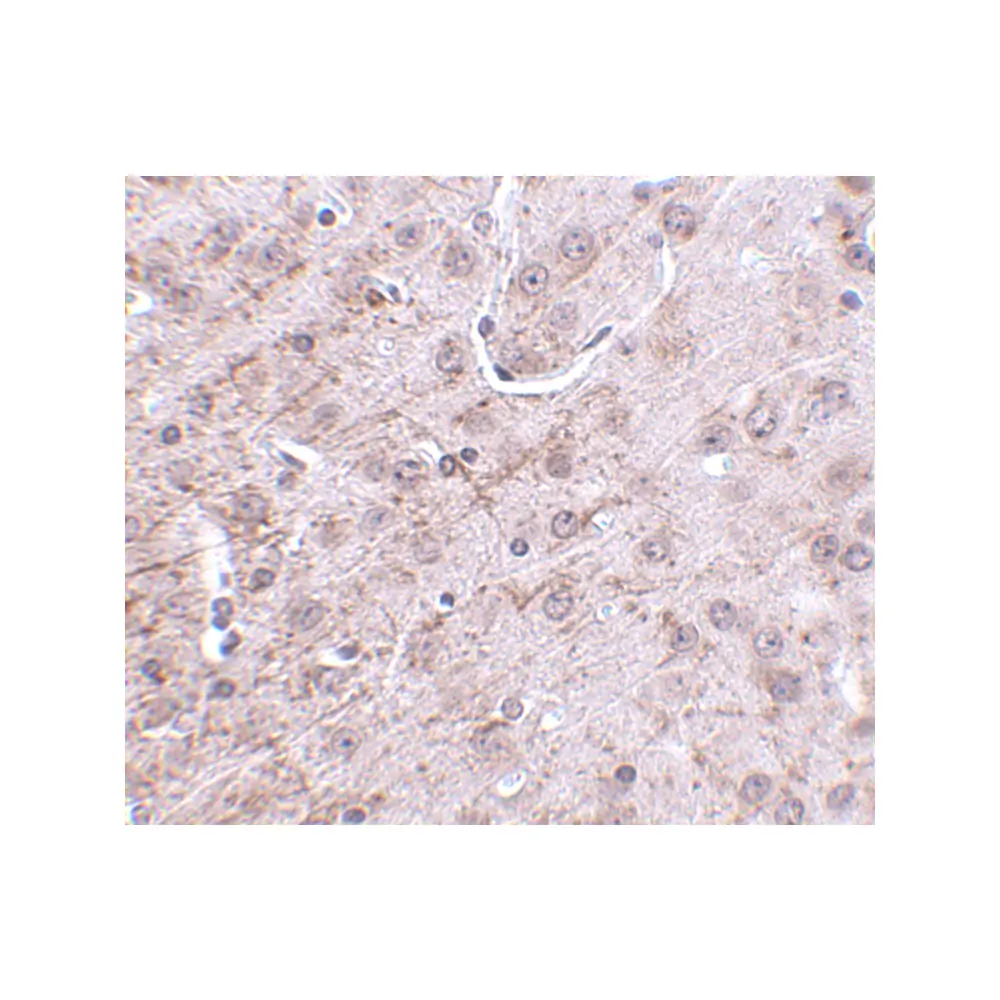 ProSci 4983_S CRMP1 Antibody, ProSci, 0.02 mg/Unit Secondary Image