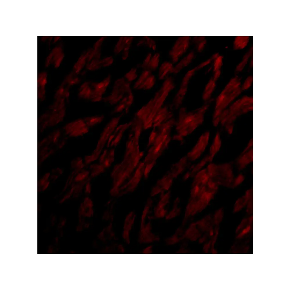 ProSci 4029 CRTH2 Antibody, ProSci, 0.1 mg/Unit Tertiary Image