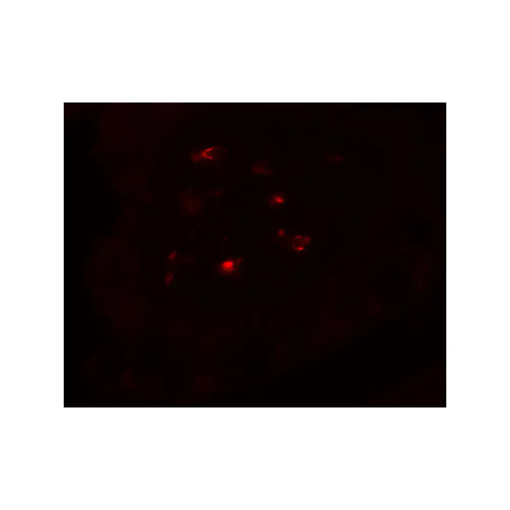 ProSci 8101_S CTHRC1 Antibody, ProSci, 0.02 mg/Unit Tertiary Image