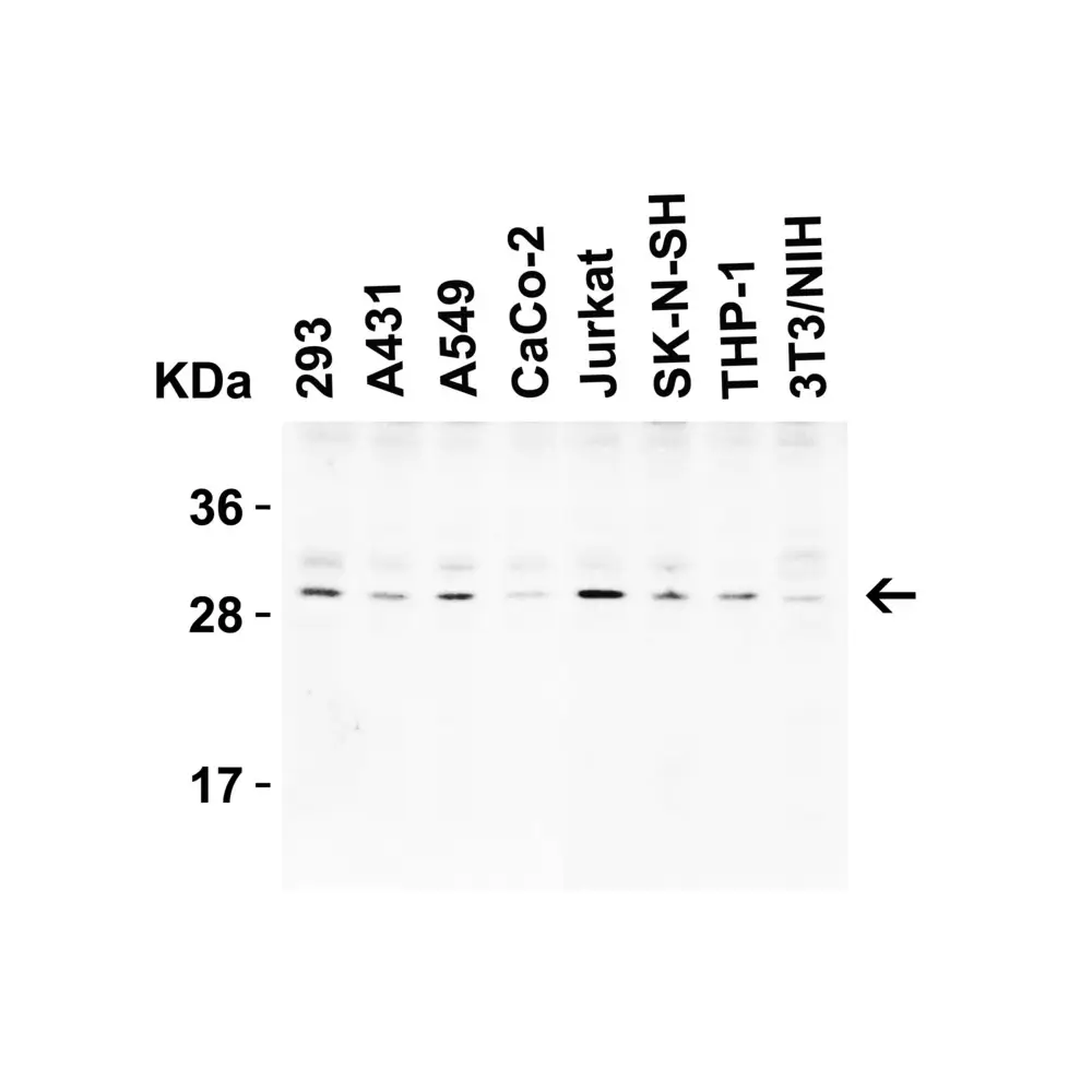 ProSci 3565_S CTRP3 Antibody, ProSci, 0.02 mg/Unit Primary Image