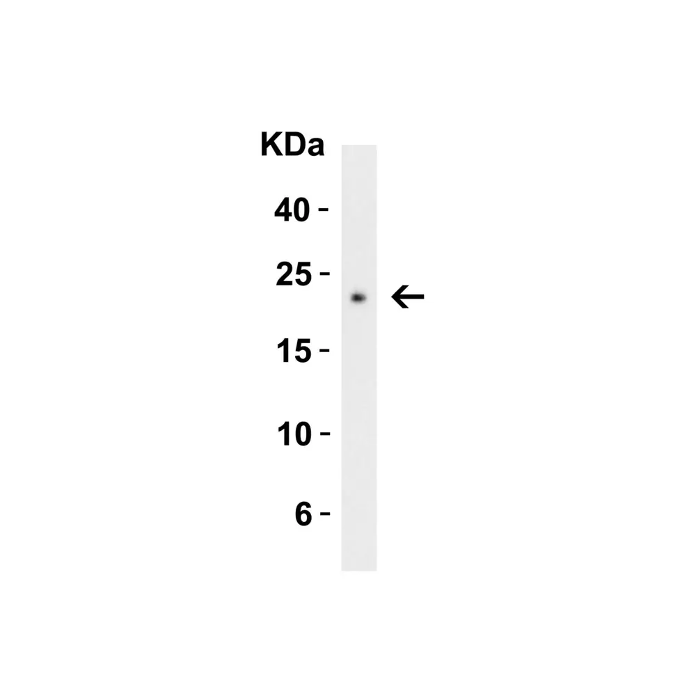 ProSci 3565_S CTRP3 Antibody, ProSci, 0.02 mg/Unit Secondary Image