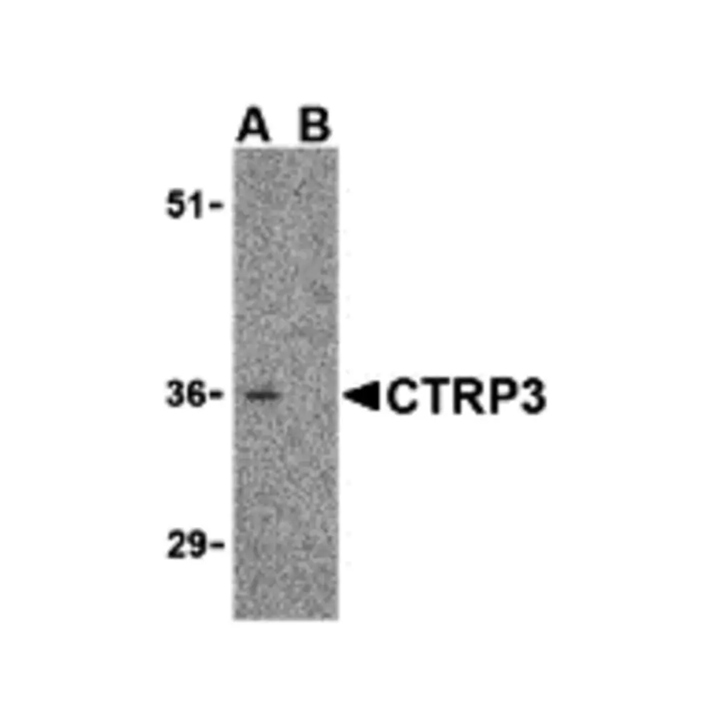 ProSci 3565_S CTRP3 Antibody, ProSci, 0.02 mg/Unit Quaternary Image
