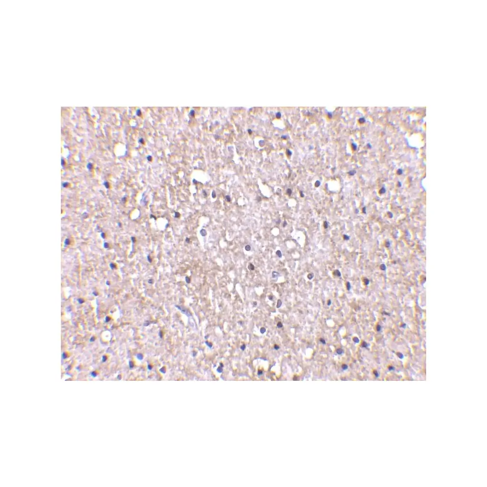 ProSci 3571_S CTRP5 Antibody, ProSci, 0.02 mg/Unit Secondary Image