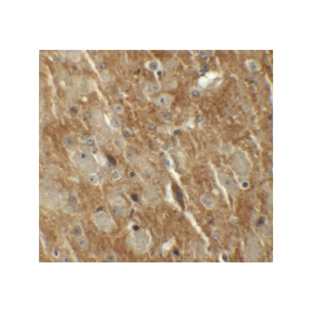 ProSci 6215 CTTNBL1 Antibody, ProSci, 0.1 mg/Unit Secondary Image