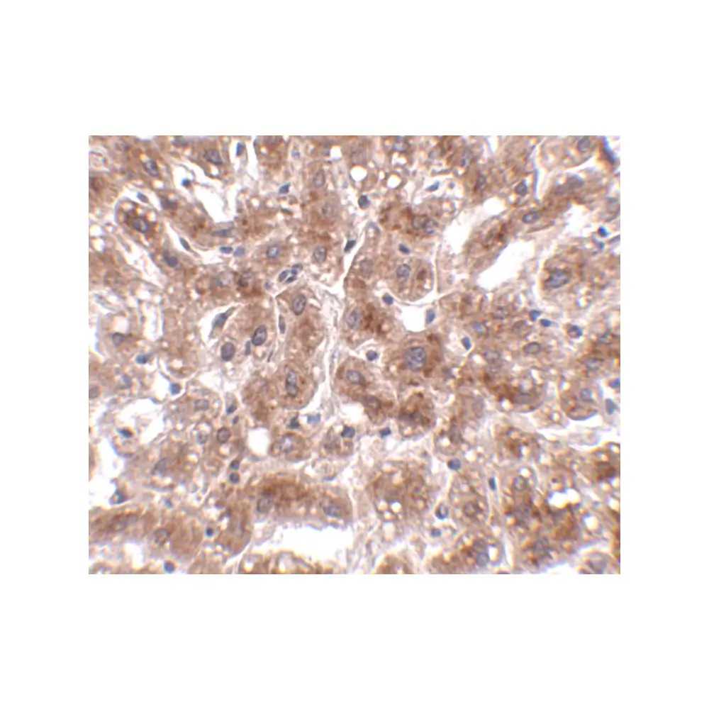 ProSci 4829 CUEDC1 Antibody, ProSci, 0.1 mg/Unit Secondary Image