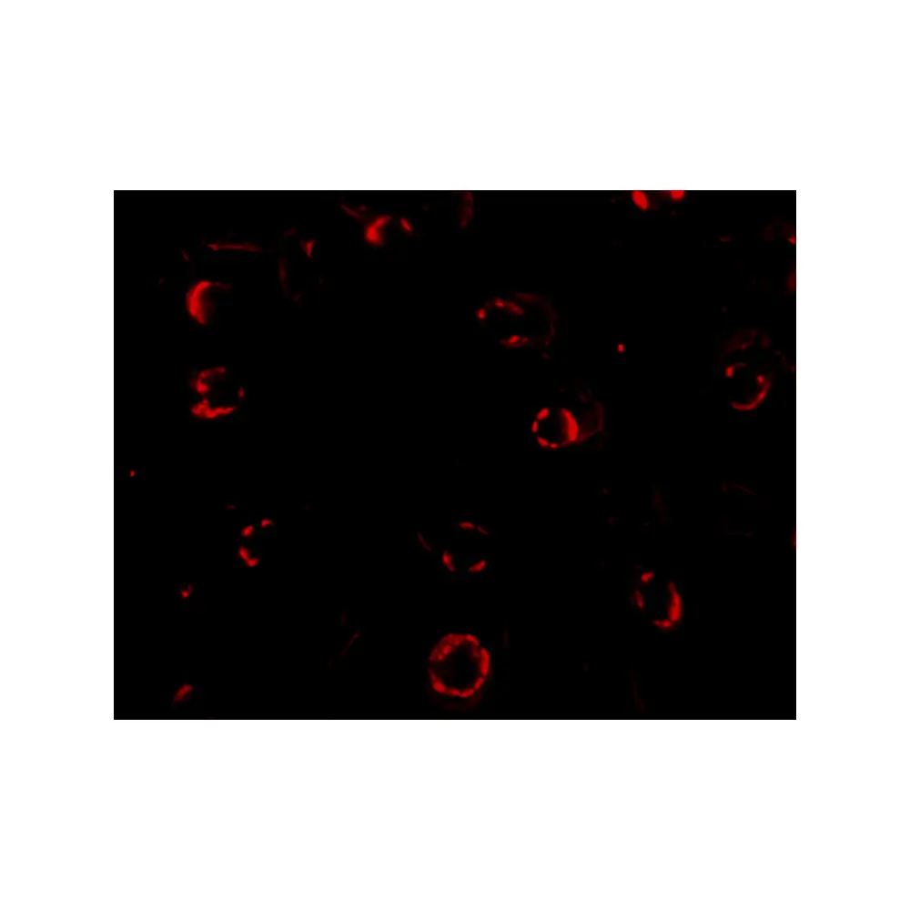ProSci 4443 CXCR4-Lo Antibody, ProSci, 0.1 mg/Unit Tertiary Image