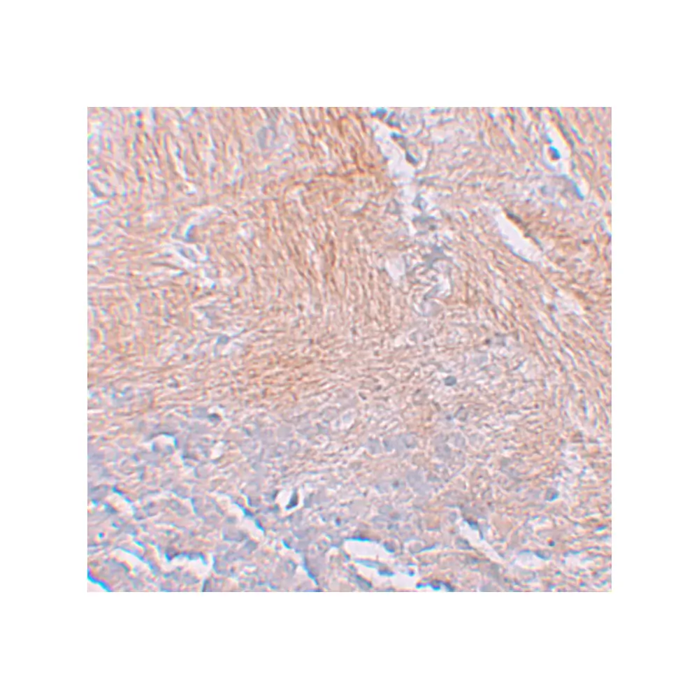 ProSci 6111 CXXC5 Antibody, ProSci, 0.1 mg/Unit Secondary Image
