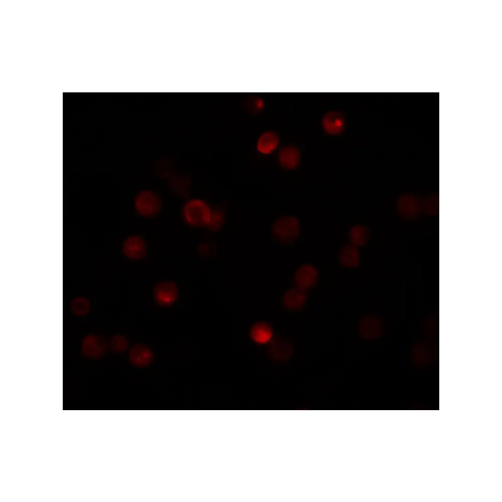 ProSci 5859 CaBP7 Antibody, ProSci, 0.1 mg/Unit Tertiary Image