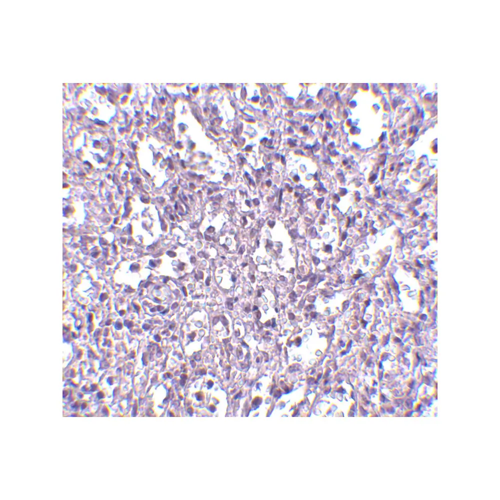 ProSci 4267_S Carabin Antibody, ProSci, 0.02 mg/Unit Secondary Image