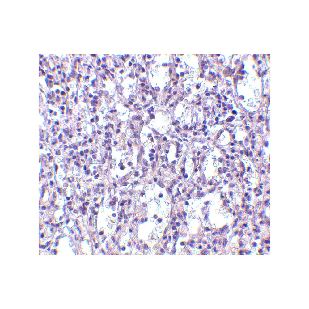ProSci 4269 Carabin Antibody, ProSci, 0.1 mg/Unit Secondary Image