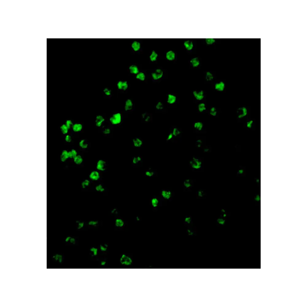 ProSci 3453 Caspase-4 Antibody, ProSci, 0.1 mg/Unit Tertiary Image