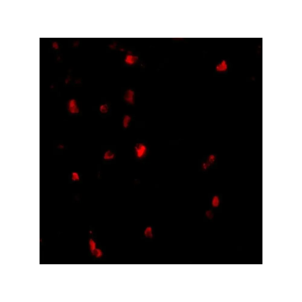 ProSci 3967 Cbl Antibody, ProSci, 0.1 mg/Unit Secondary Image