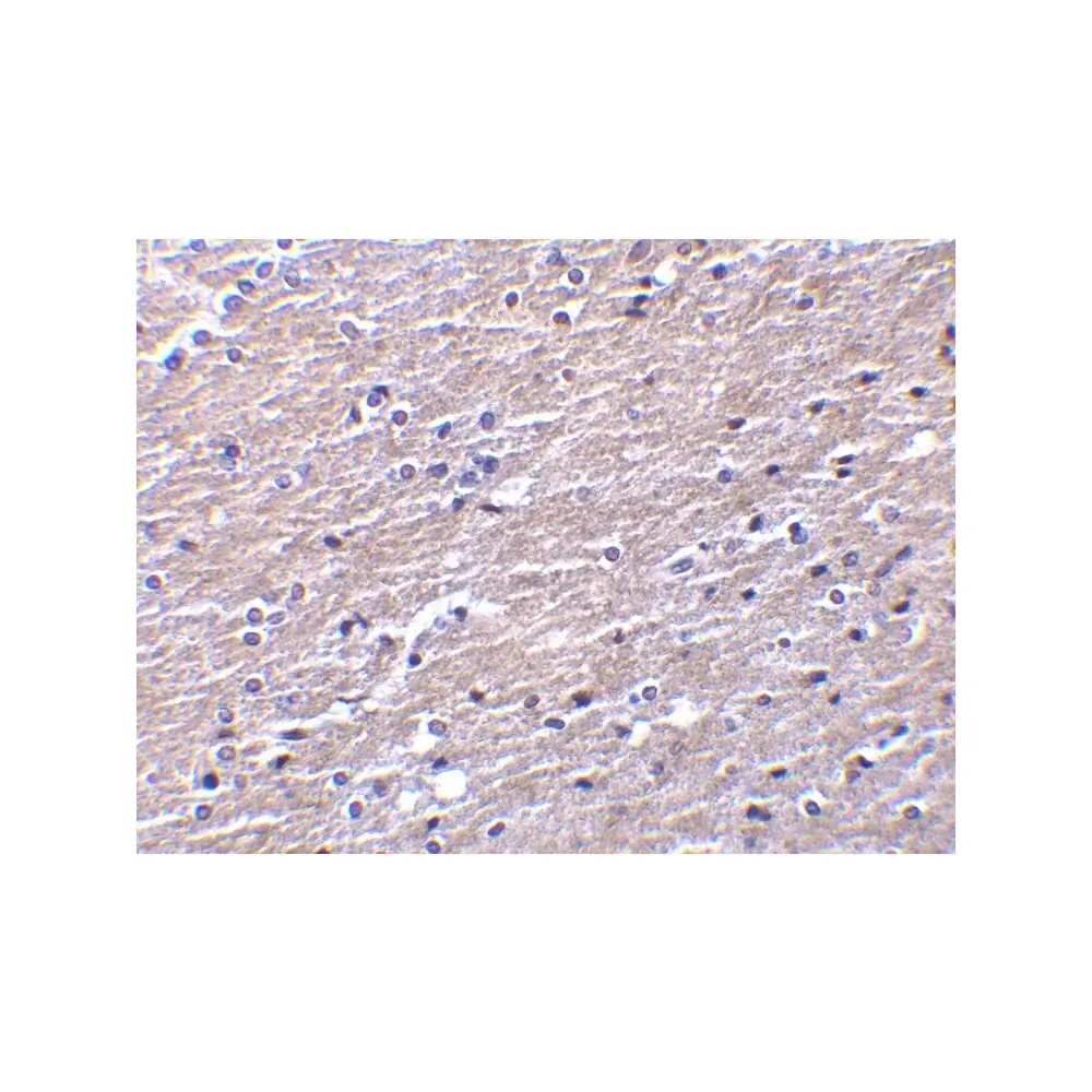 ProSci 3856 Clusterin Antibody, ProSci, 0.1 mg/Unit Quaternary Image