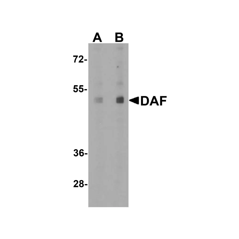 ProSci 7937_S DAF Antibody, ProSci, 0.02 mg/Unit Quaternary Image
