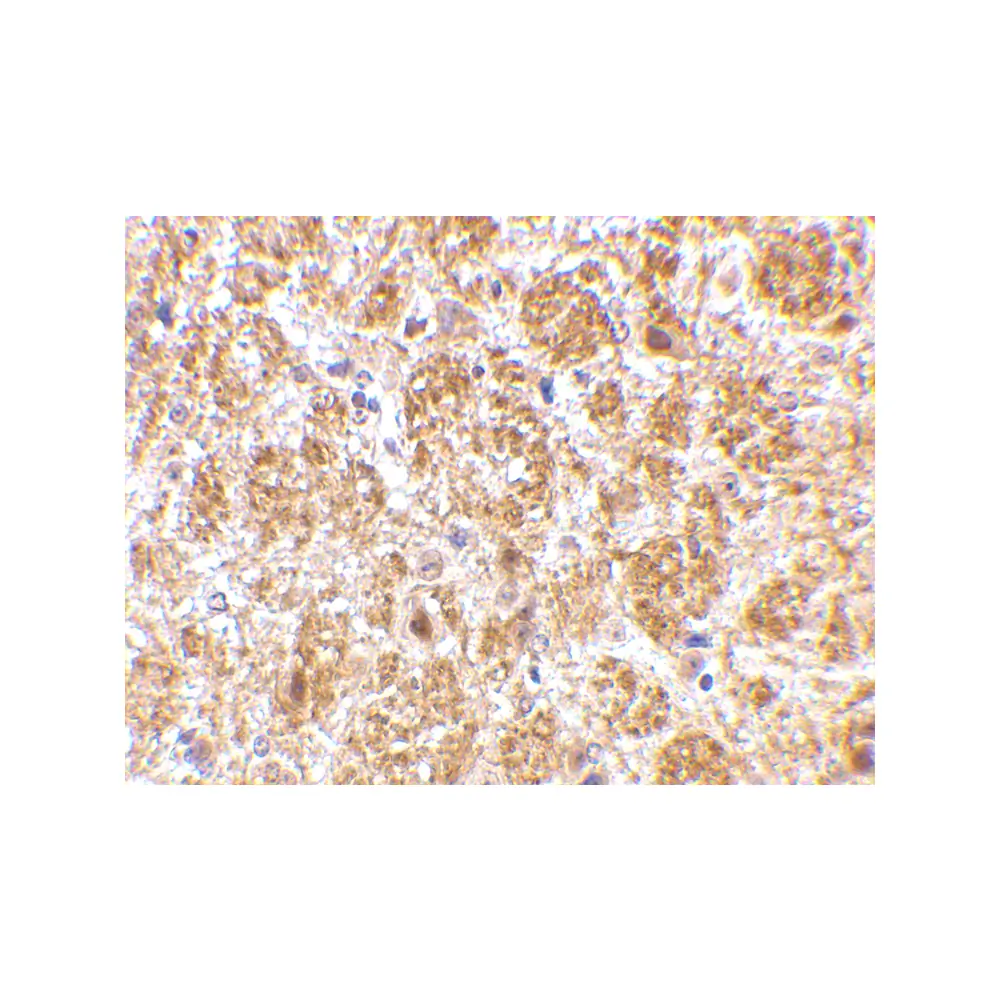 ProSci 4069 DARC Antibody, ProSci, 0.1 mg/Unit Secondary Image