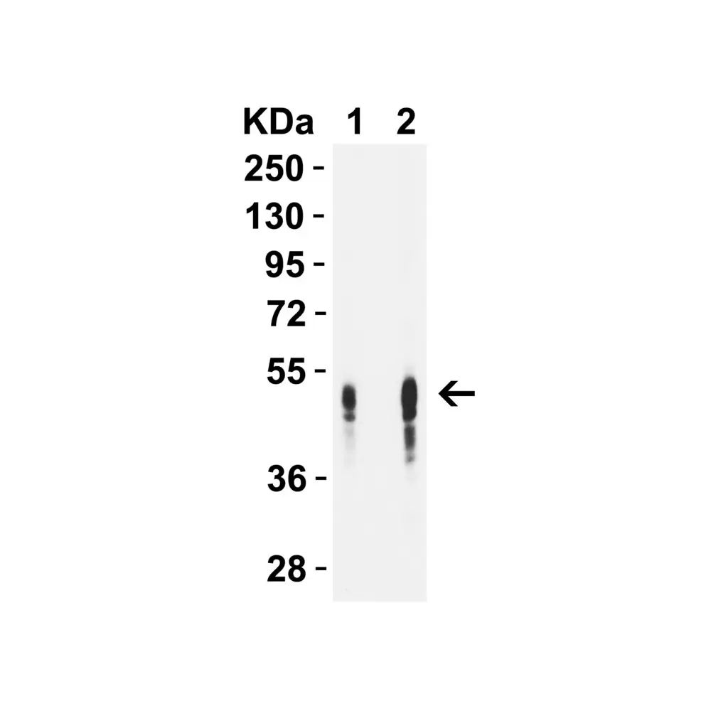 ProSci PM-2347 DC-SIGN Antibody [5D7] , ProSci, 0.1 mg/Unit Primary Image