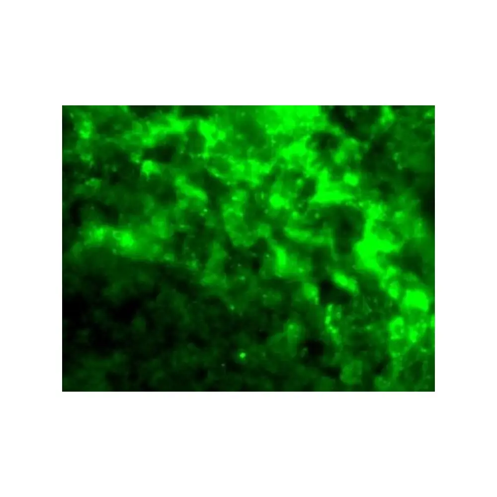ProSci 2347 DC-SIGN Antibody, ProSci, 0.1 mg/Unit Tertiary Image