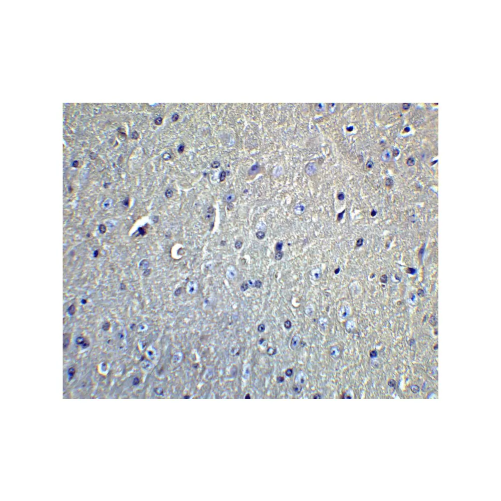 ProSci 5633_S DCLK1 Antibody, ProSci, 0.02 mg/Unit Quaternary Image