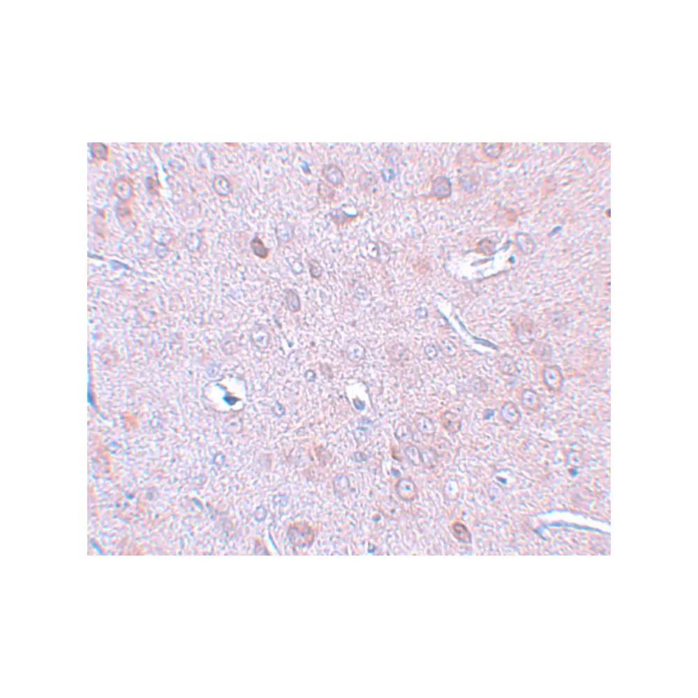 ProSci 5633_S DCLK1 Antibody, ProSci, 0.02 mg/Unit Secondary Image