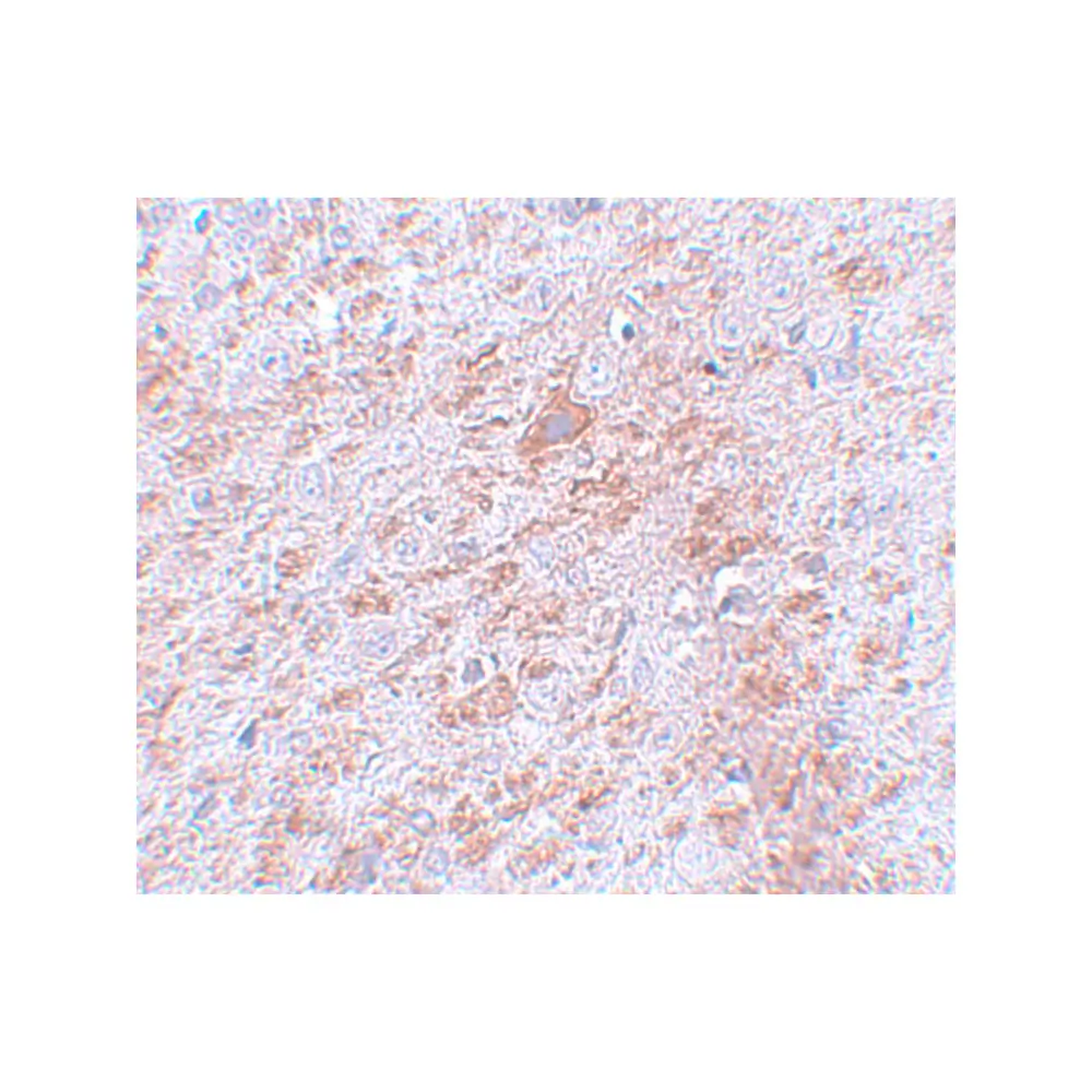 ProSci 5635 DCLK2 Antibody, ProSci, 0.1 mg/Unit Secondary Image