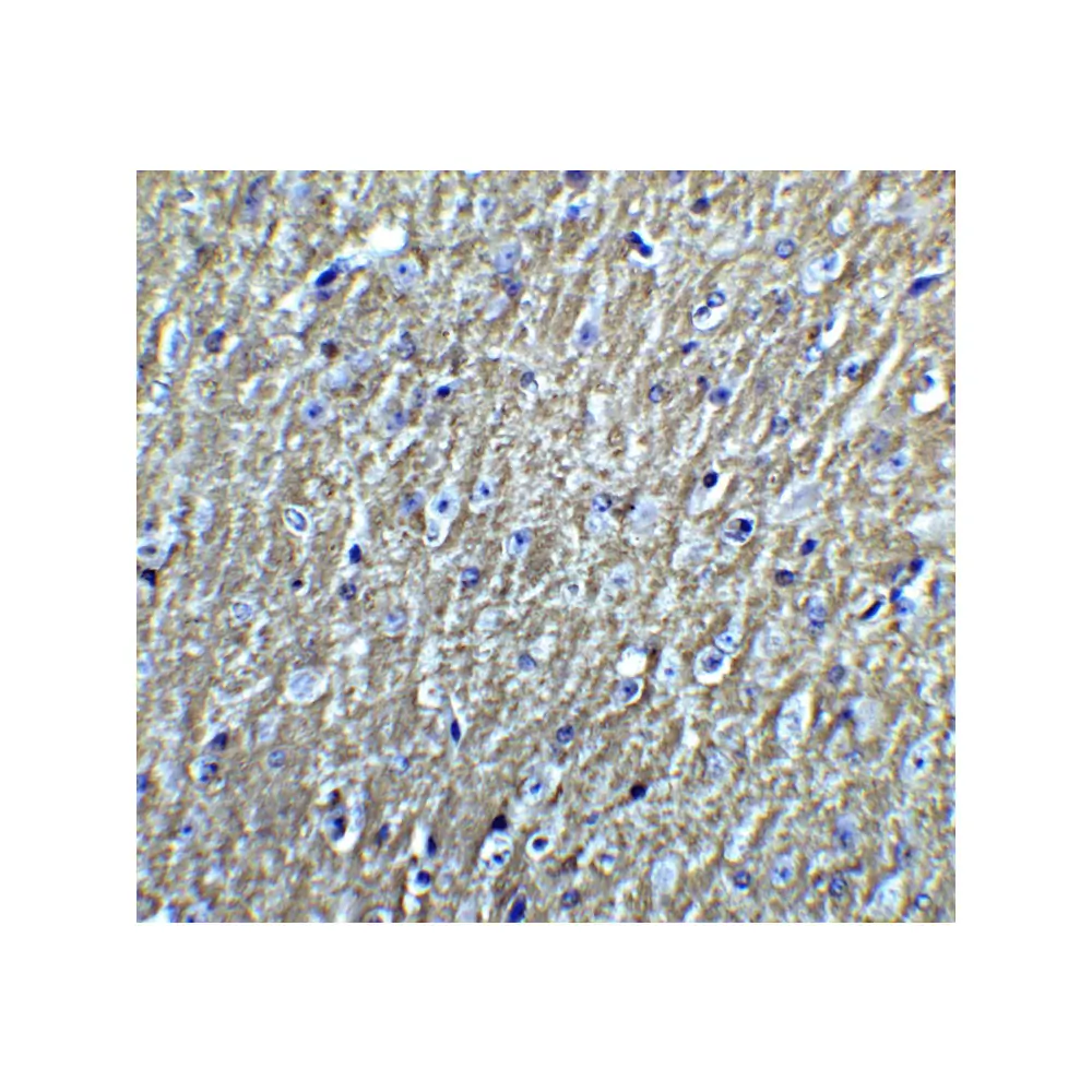 ProSci 5637 DCLK3 Antibody, ProSci, 0.1 mg/Unit Tertiary Image