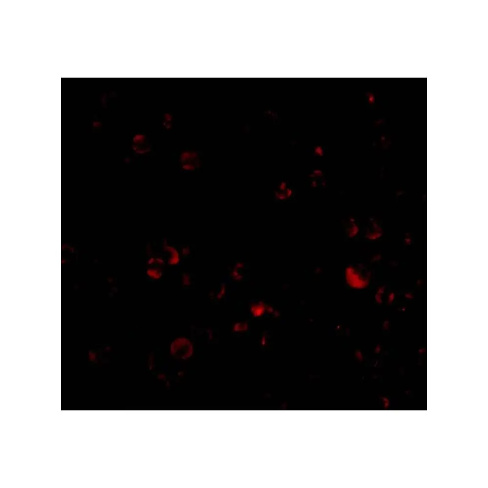 ProSci 3757 DDX3 Antibody, ProSci, 0.1 mg/Unit Tertiary Image