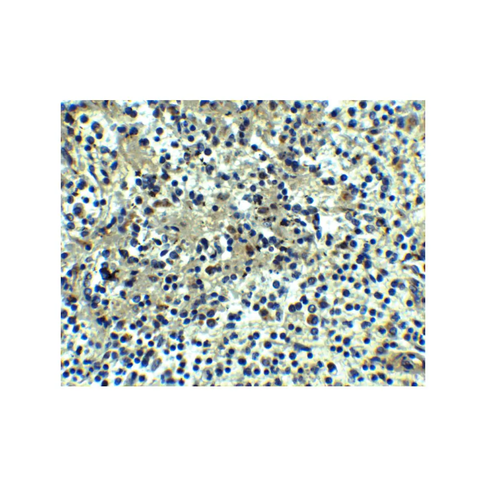 ProSci 8283 DEPDC1B Antibody, ProSci, 0.1 mg/Unit Secondary Image