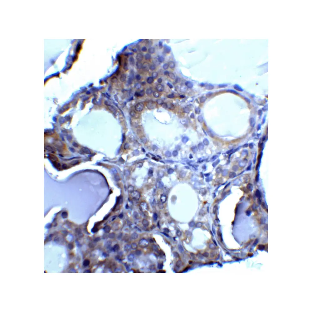 ProSci 2059 DNase II Antibody, ProSci, 0.1 mg/Unit Quaternary Image