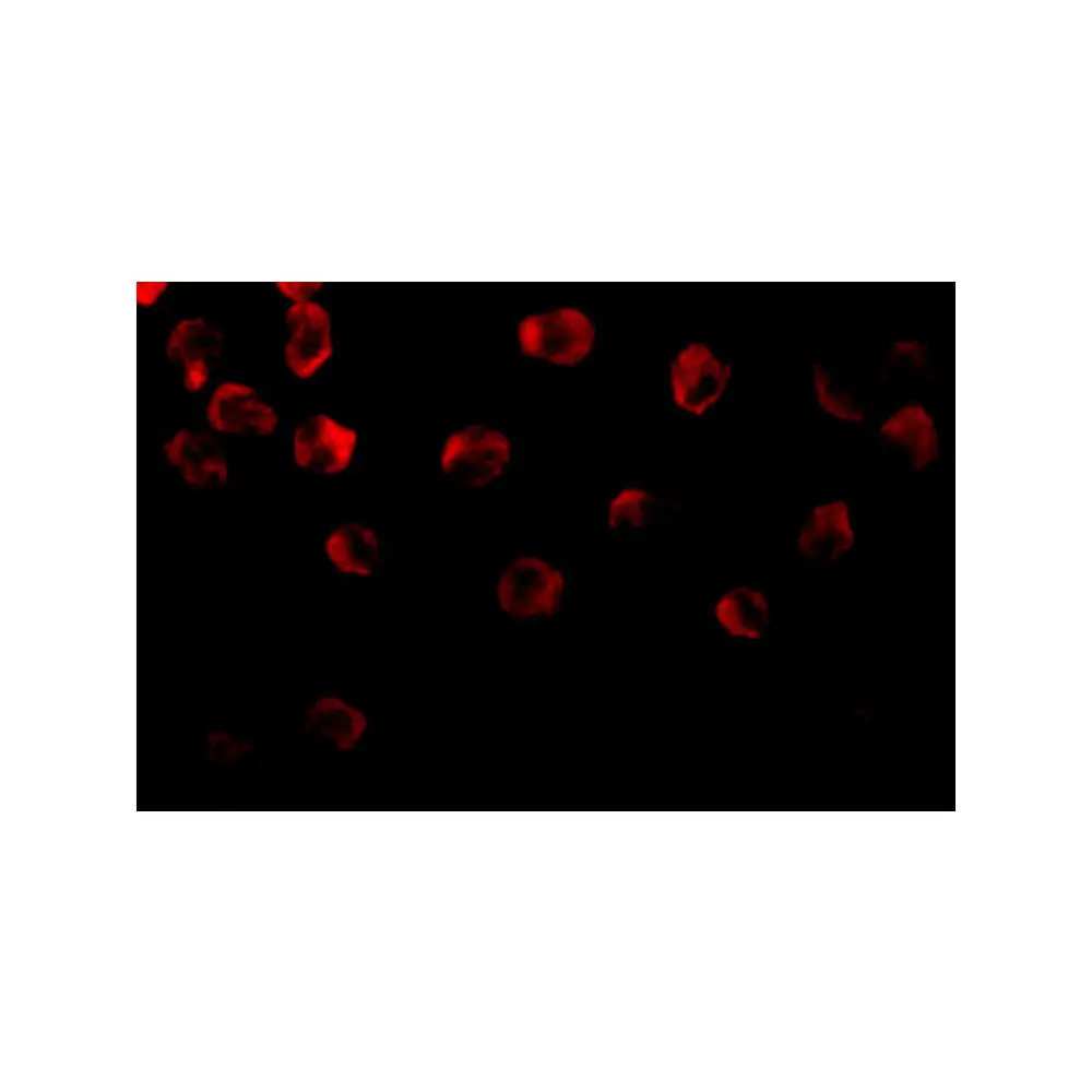 ProSci 1107 DOK1 Antibody, ProSci, 0.1 mg/Unit Tertiary Image