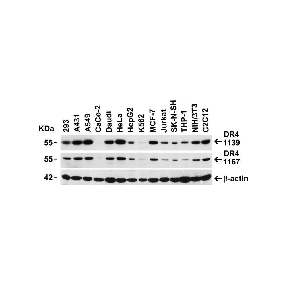 ProSci 1139 DR4 Antibody, ProSci, 0.1 mg/Unit Secondary Image