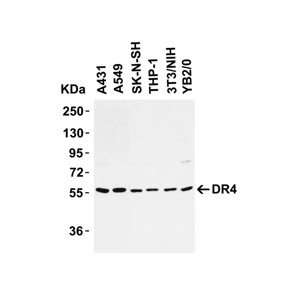 ProSci 1139_S DR4 Antibody, ProSci, 0.02 mg/Unit Tertiary Image