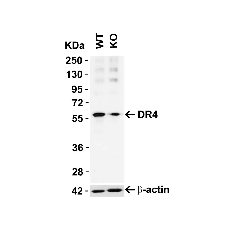 ProSci 1139_S DR4 Antibody, ProSci, 0.02 mg/Unit Primary Image