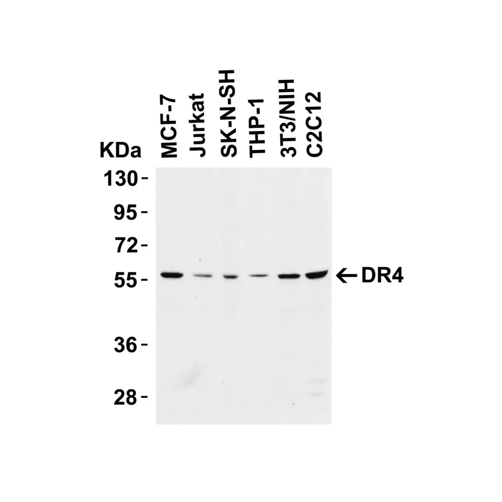 ProSci 1167_S DR4 Antibody, ProSci, 0.02 mg/Unit Tertiary Image