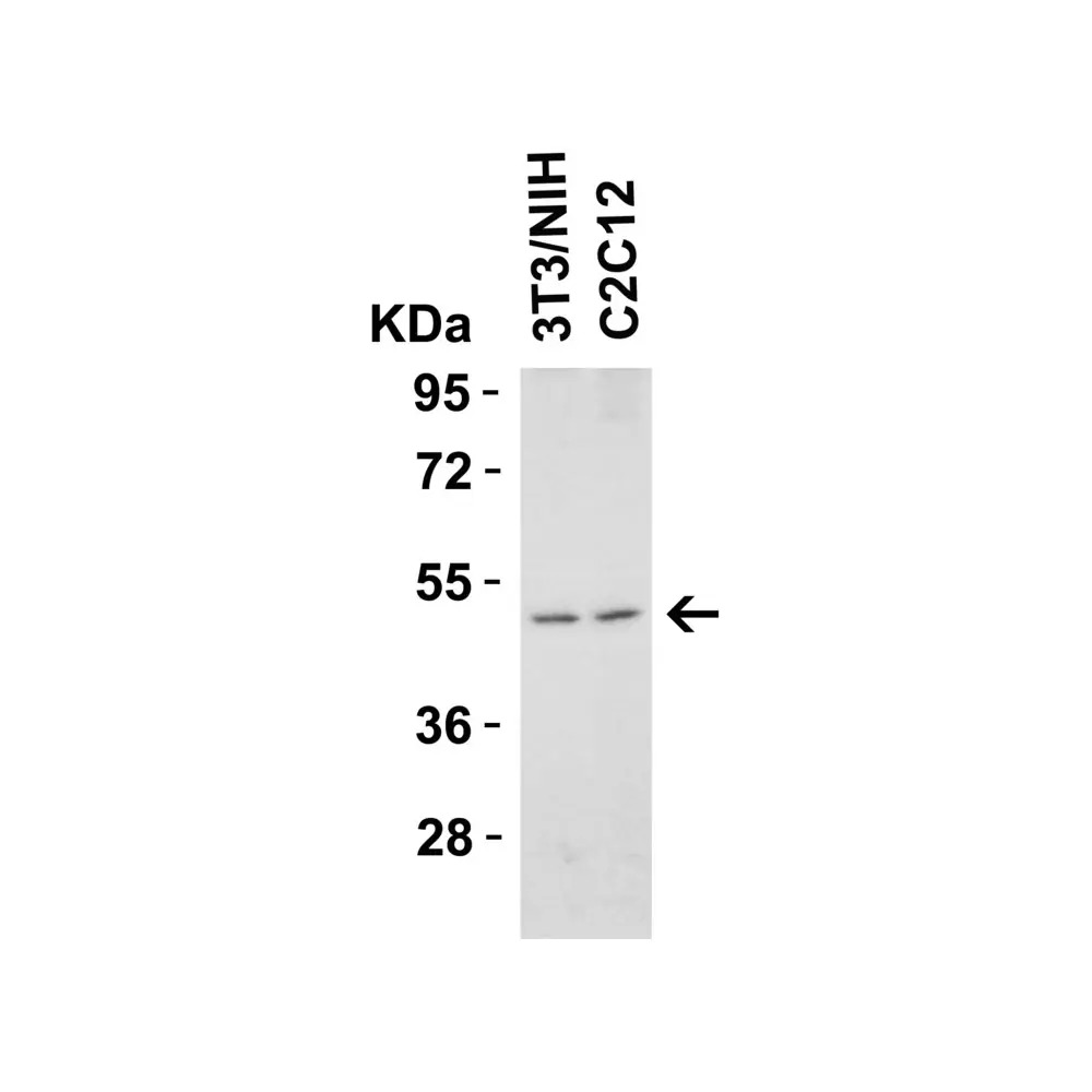 ProSci 2019 DR5 Antibody, ProSci, 0.1 mg/Unit Quaternary Image