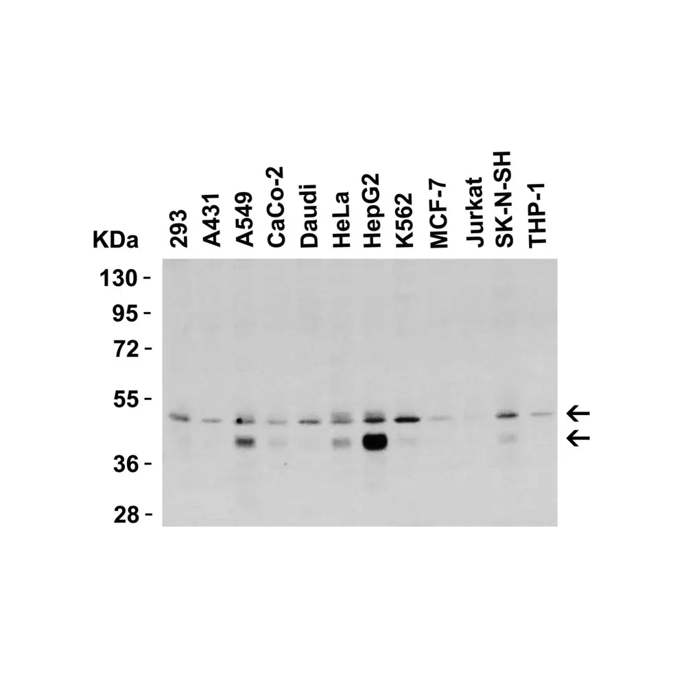 ProSci 2019 DR5 Antibody, ProSci, 0.1 mg/Unit Primary Image