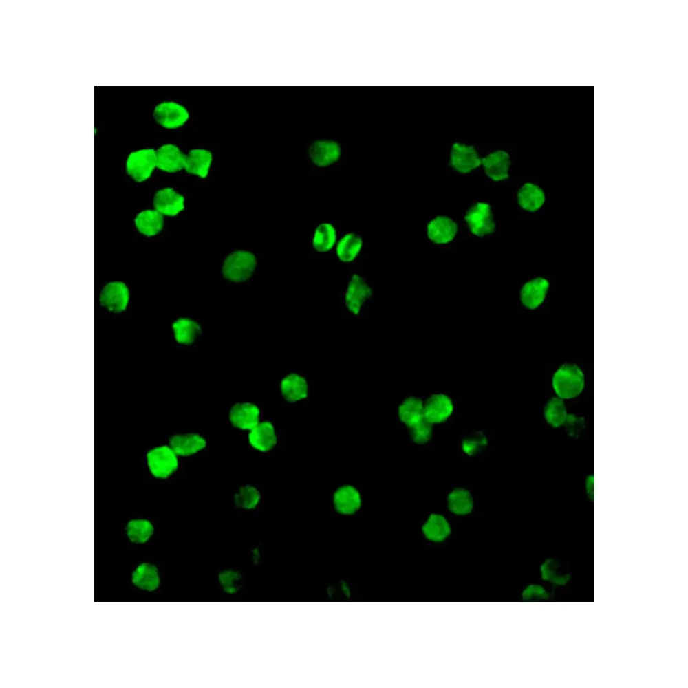 ProSci 2147 DRAK1 Antibody, ProSci, 0.1 mg/Unit Tertiary Image